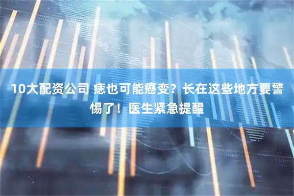 10大配资公司 痣也可能癌变？长在这些地方要警惕了！医生紧急提醒
